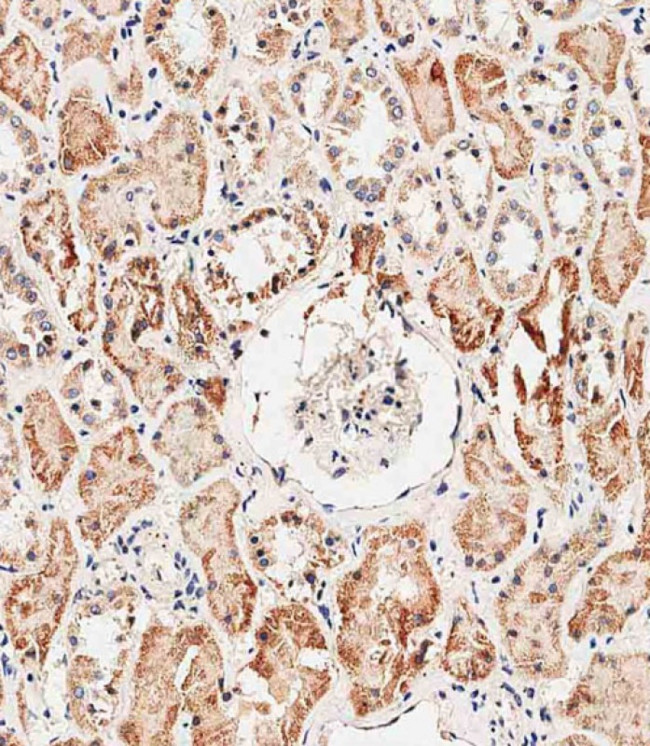 REA Antibody in Immunohistochemistry (Paraffin) (IHC (P))