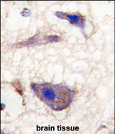 NPTX1 Antibody in Immunohistochemistry (Paraffin) (IHC (P))