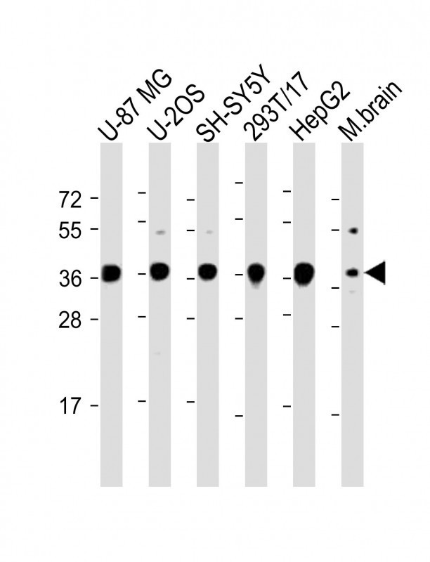 EN1 Antibody in Western Blot (WB)