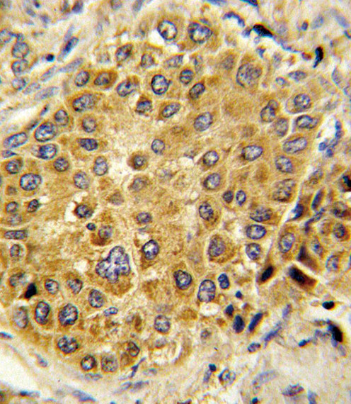 Plasminogen Antibody in Immunohistochemistry (Paraffin) (IHC (P))