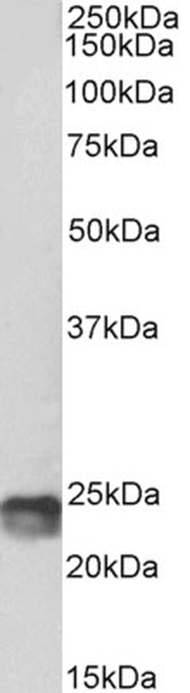 SOCS1 Antibody in Western Blot (WB)