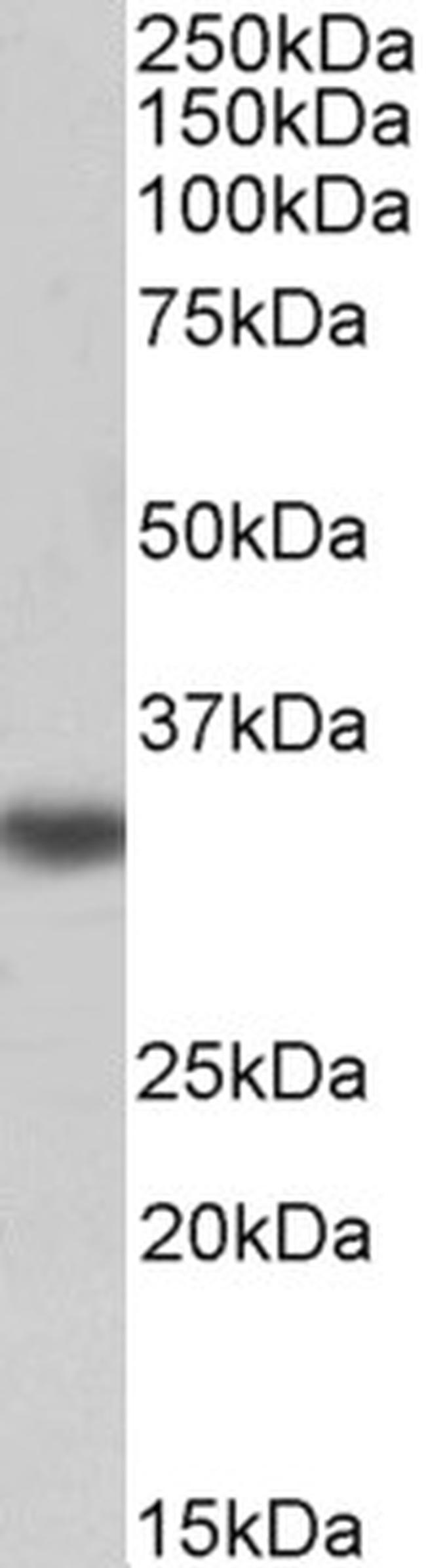 TMX Antibody in Western Blot (WB)