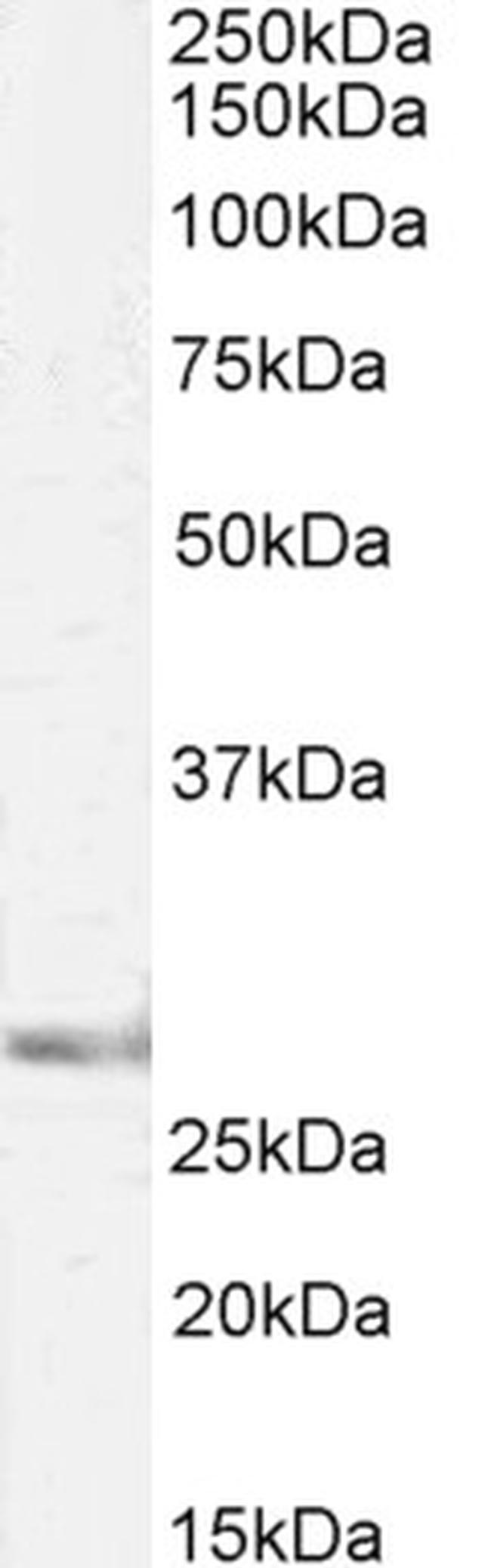 SIAH1 Antibody in Western Blot (WB)