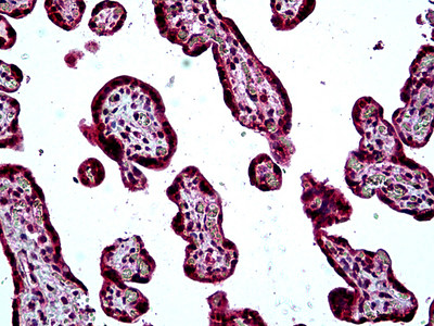 SH3KBP1 Antibody in Immunohistochemistry (Paraffin) (IHC (P))