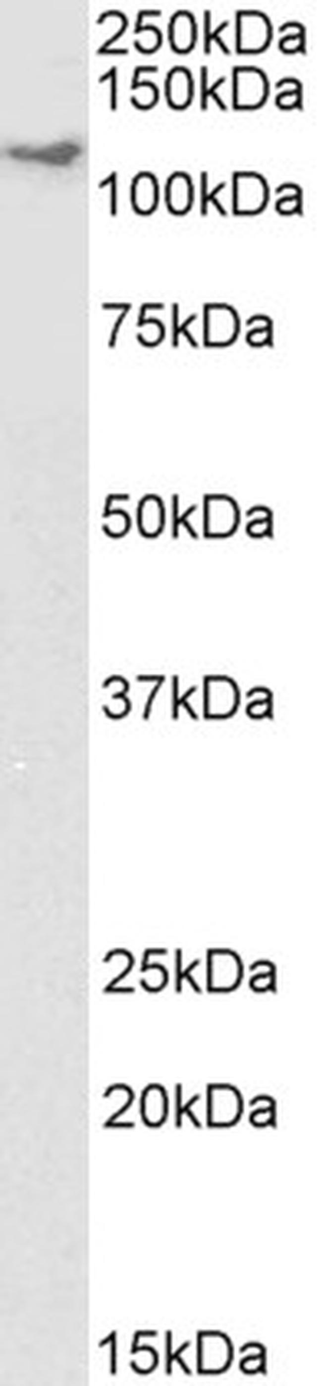 Kinesin 5B Antibody in Western Blot (WB)