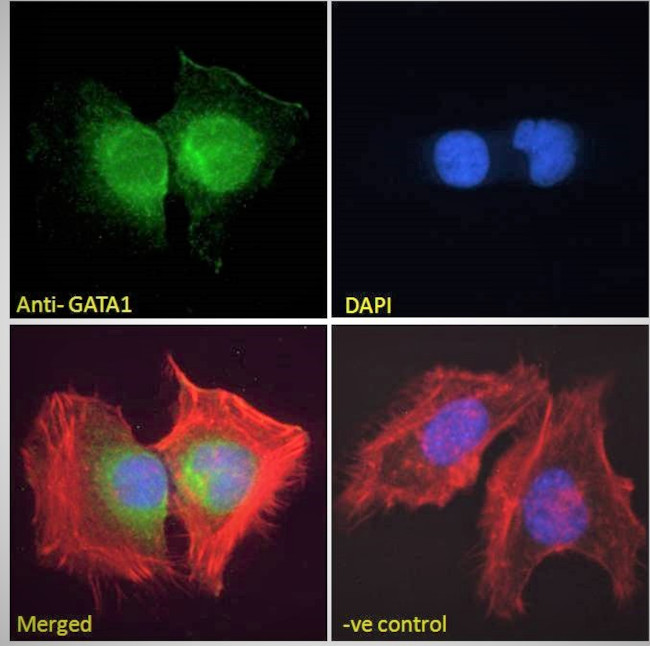 GATA1 Antibody in Immunocytochemistry (ICC/IF)