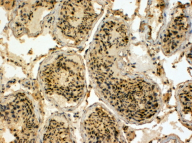 HYD Antibody in Immunohistochemistry (Paraffin) (IHC (P))