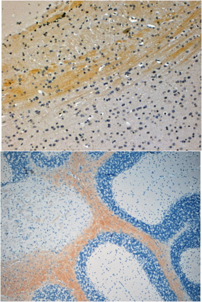 JIP3 Antibody in Immunohistochemistry (Paraffin) (IHC (P))