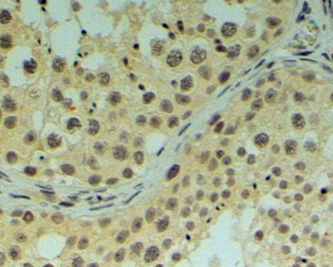 REV1 Antibody in Immunohistochemistry (Paraffin) (IHC (P))