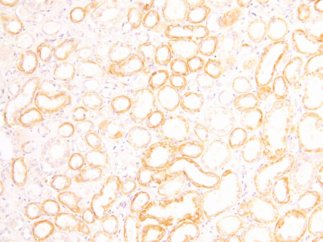 FOXD1 Antibody in Immunohistochemistry (Paraffin) (IHC (P))