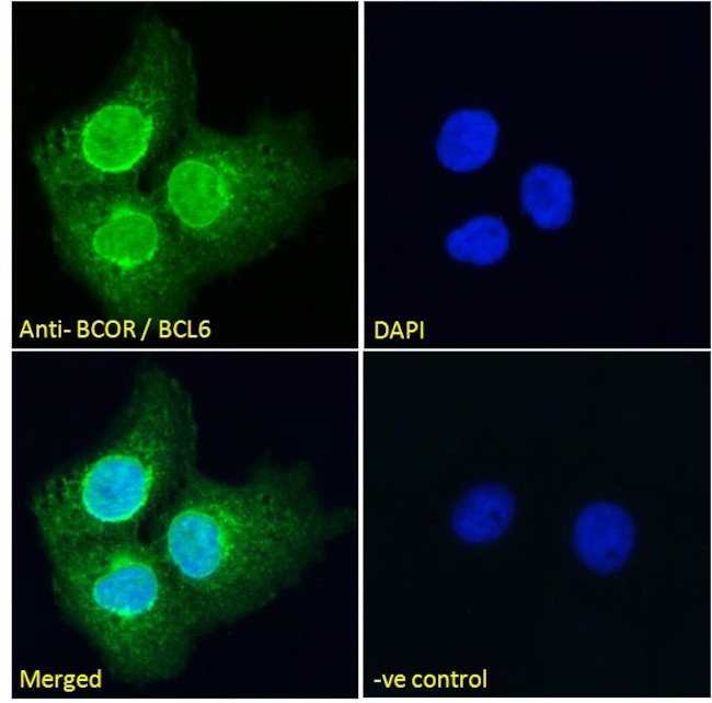 BCOR Antibody in Immunocytochemistry (ICC/IF)