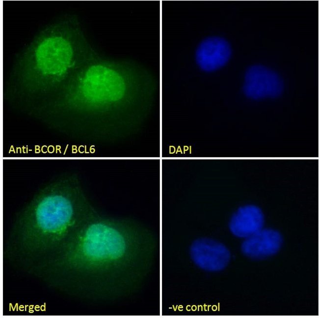 BCOR Antibody in Immunocytochemistry (ICC/IF)