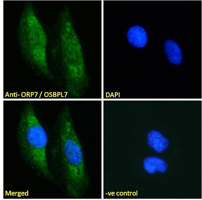 ORP7 Antibody in Immunocytochemistry (ICC/IF)