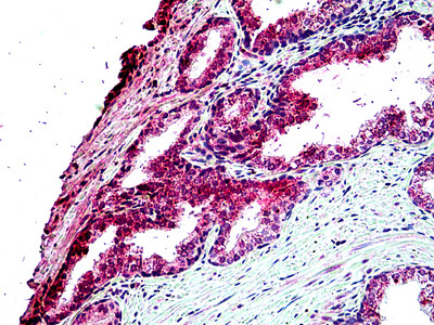 TBC1D10A Antibody in Immunohistochemistry (Paraffin) (IHC (P))