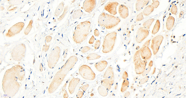 BTRC Antibody in Immunohistochemistry (Paraffin) (IHC (P))