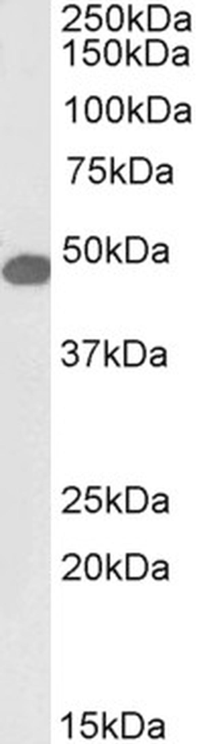 SNX5 Antibody in Western Blot (WB)