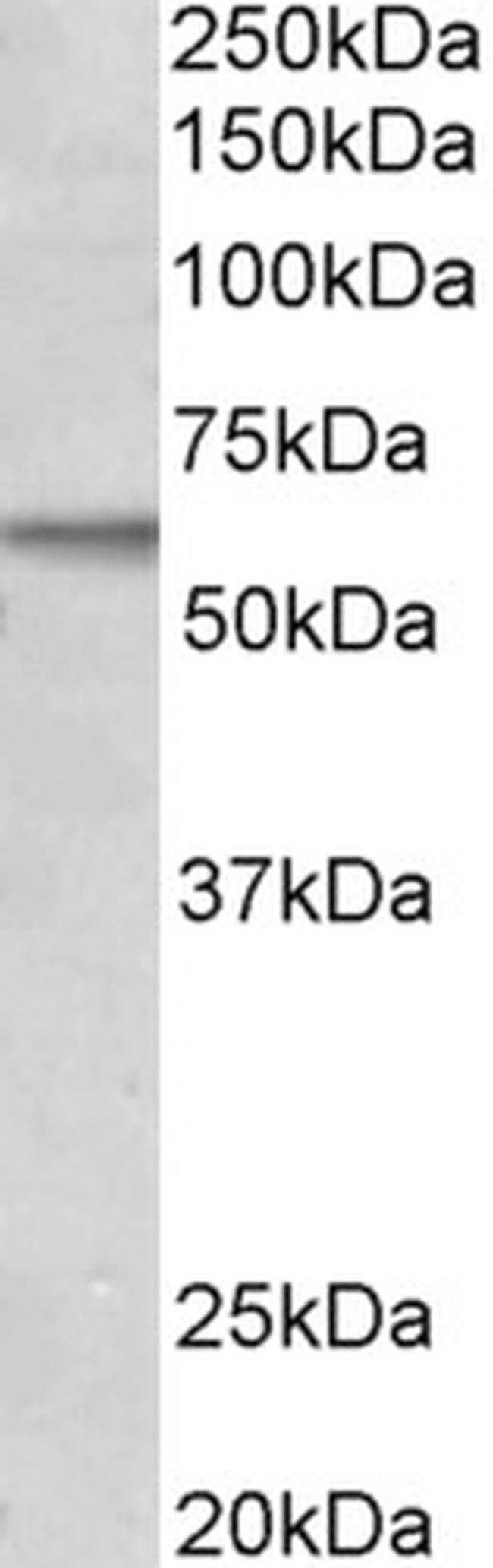 ACVRL1 Antibody in Western Blot (WB)