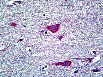 EDF1 Antibody in Immunohistochemistry (Paraffin) (IHC (P))