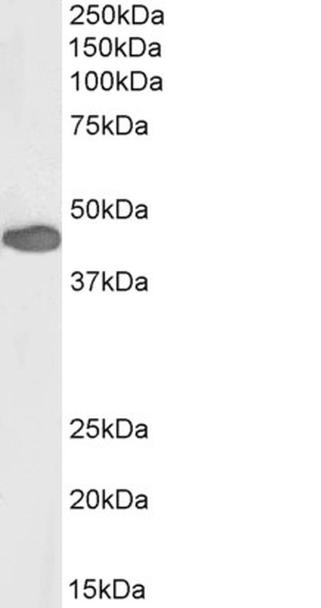 PAX3 Antibody in Western Blot (WB)