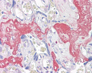 XAGE-1d Antibody in Immunohistochemistry (Paraffin) (IHC (P))