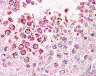 XAGE-1d Antibody in Immunohistochemistry (Paraffin) (IHC (P))