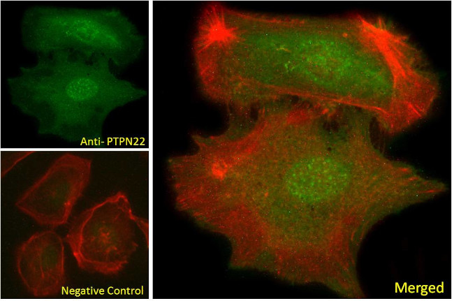 PTPN22 Antibody in Immunocytochemistry (ICC/IF)