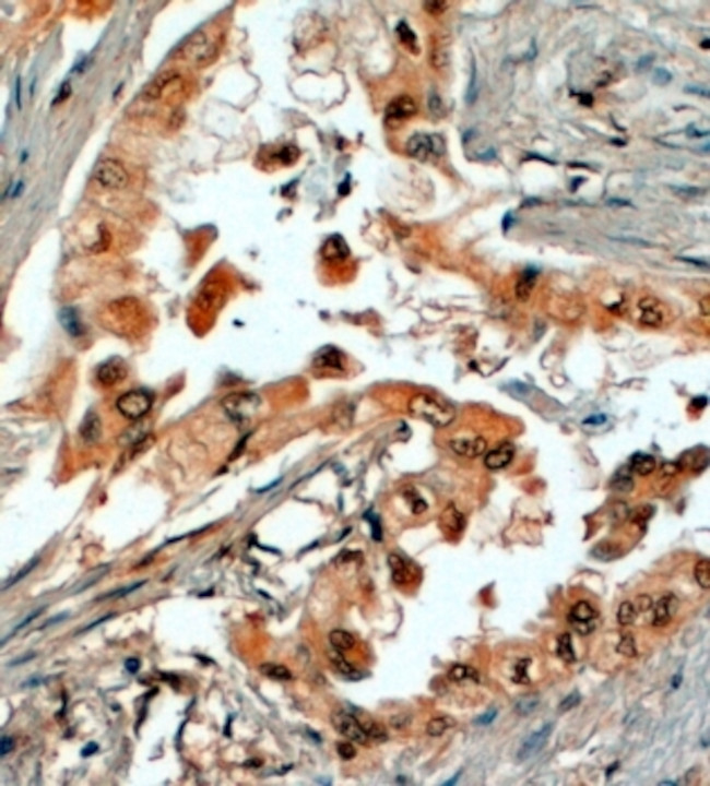 SRD5A1 Antibody in Immunohistochemistry (Paraffin) (IHC (P))