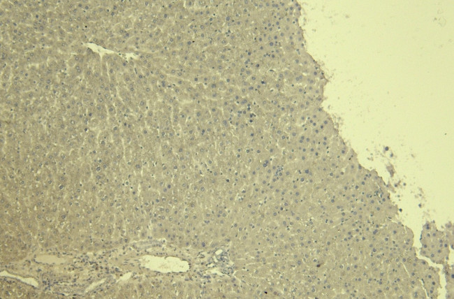 CTGF Antibody in Immunohistochemistry (Paraffin) (IHC (P))