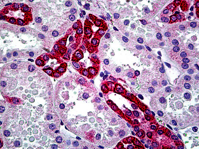 CFTR Antibody in Immunohistochemistry (Paraffin) (IHC (P))