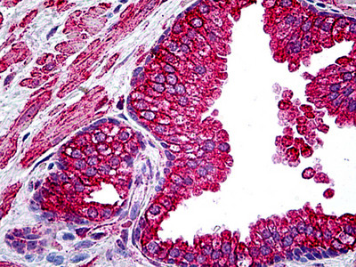 CFTR Antibody in Immunohistochemistry (Paraffin) (IHC (P))