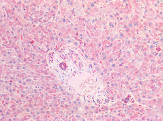 CFTR Antibody in Immunohistochemistry (Paraffin) (IHC (P))