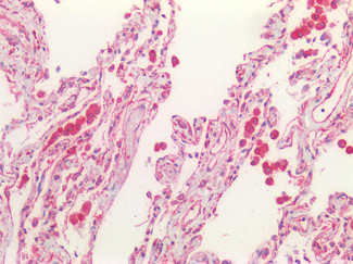 CFTR Antibody in Immunohistochemistry (Paraffin) (IHC (P))