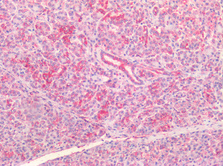 CFTR Antibody in Immunohistochemistry (Paraffin) (IHC (P))