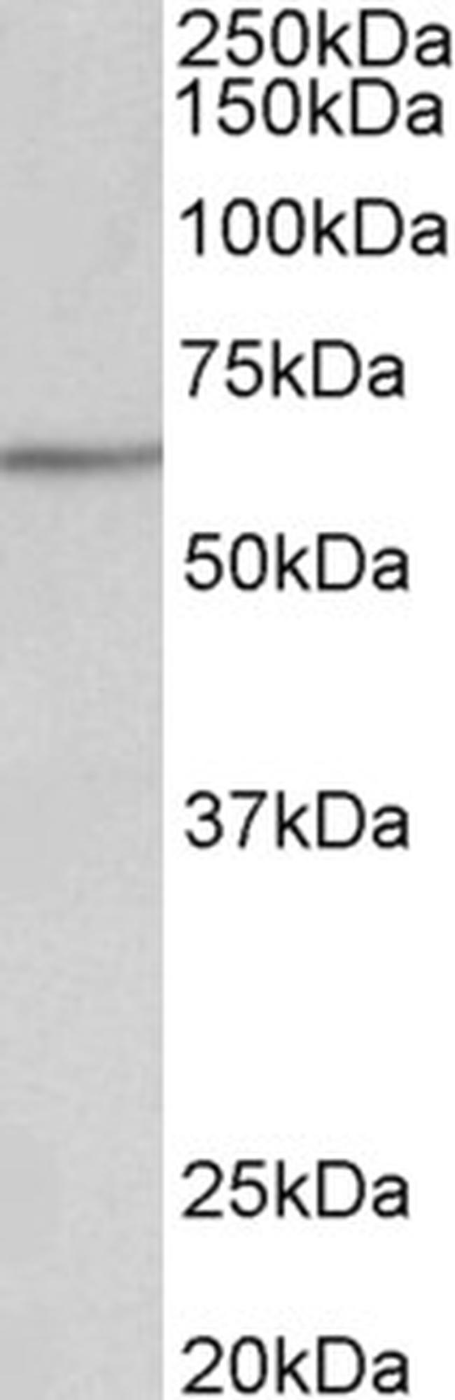 AKT2 Antibody in Western Blot (WB)