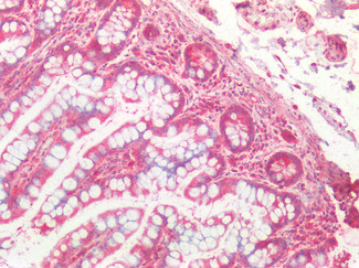 Cathepsin B Antibody in Immunohistochemistry (Paraffin) (IHC (P))