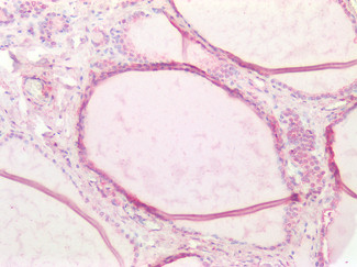 Cathepsin B Antibody in Immunohistochemistry (Paraffin) (IHC (P))