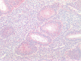 Cathepsin B Antibody in Immunohistochemistry (Paraffin) (IHC (P))