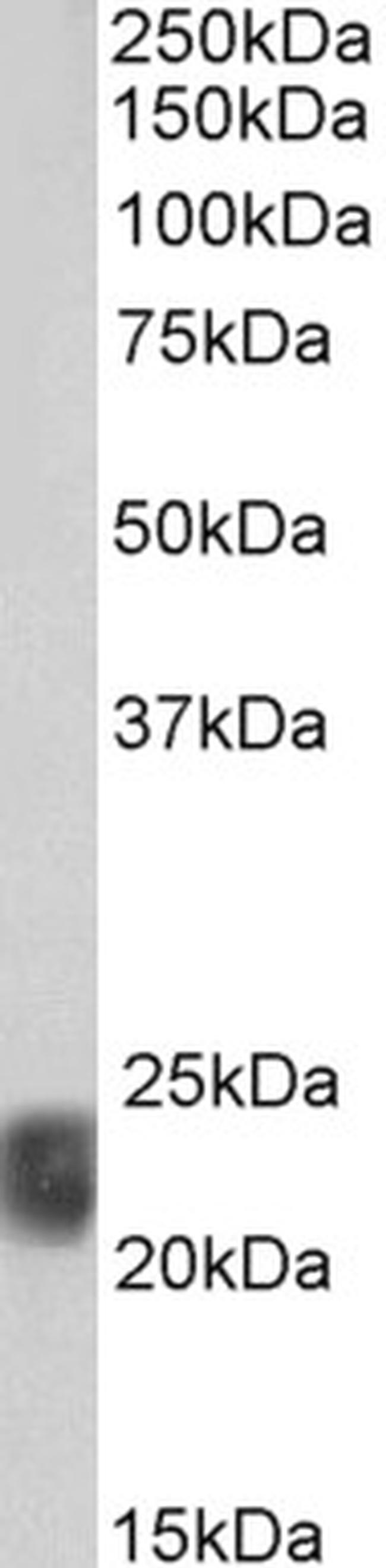 Caveolin 1 Antibody in Western Blot (WB)