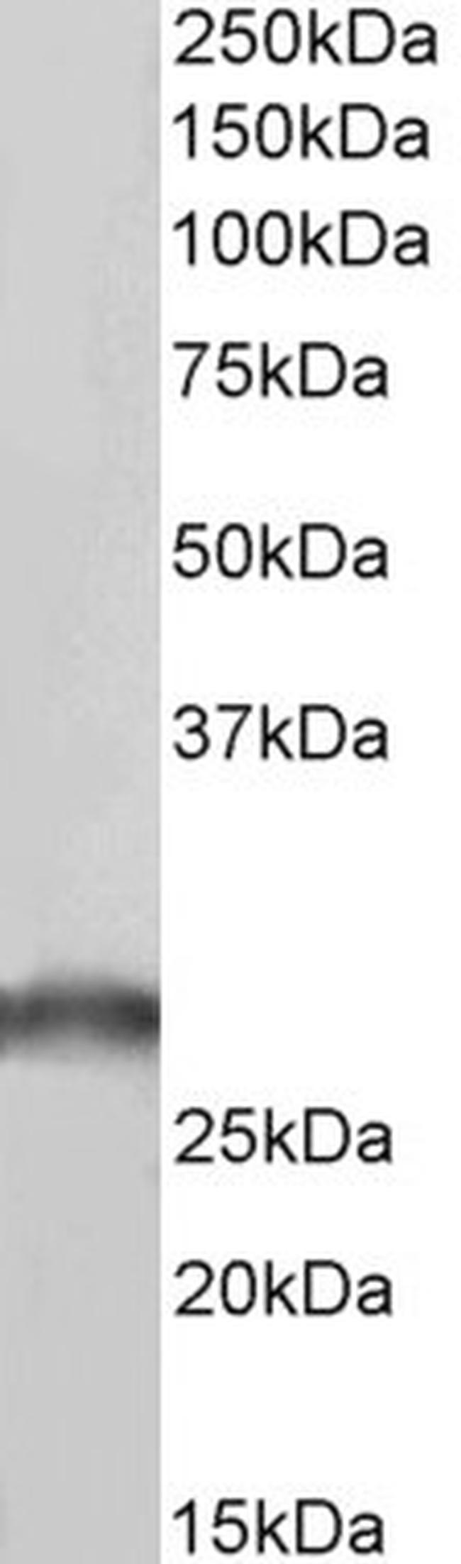 SDHB Antibody in Western Blot (WB)