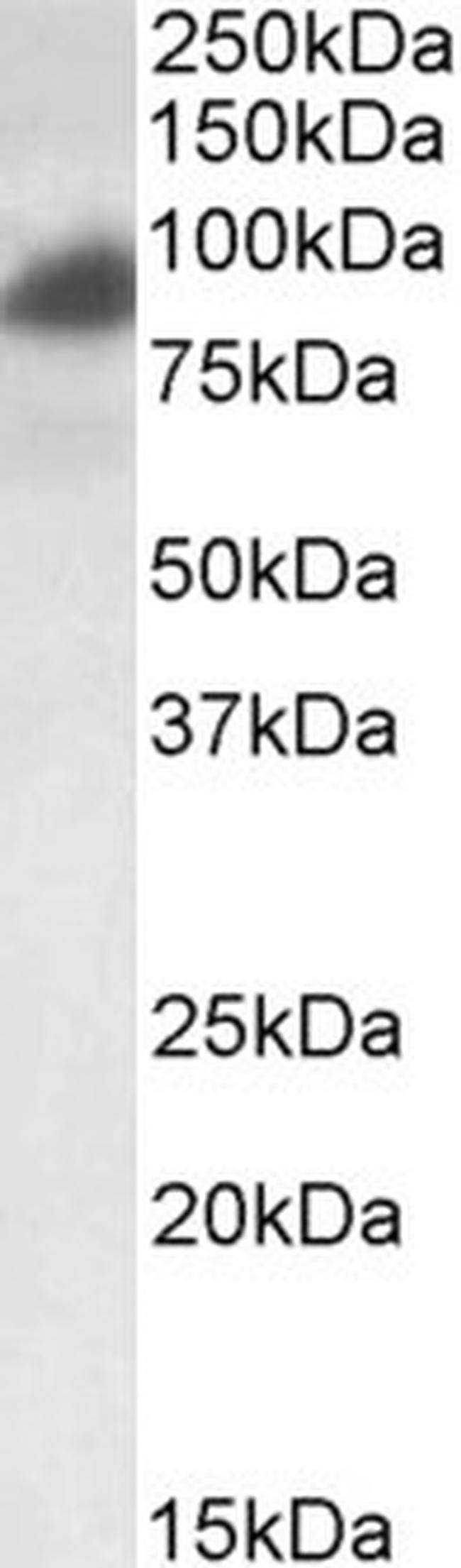 RAB11FIP1 Antibody in Western Blot (WB)