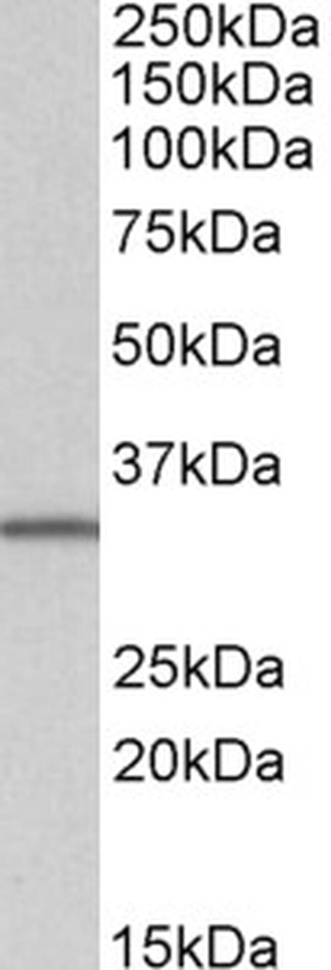 NHERF2 (Isoform B/E) Antibody in Western Blot (WB)