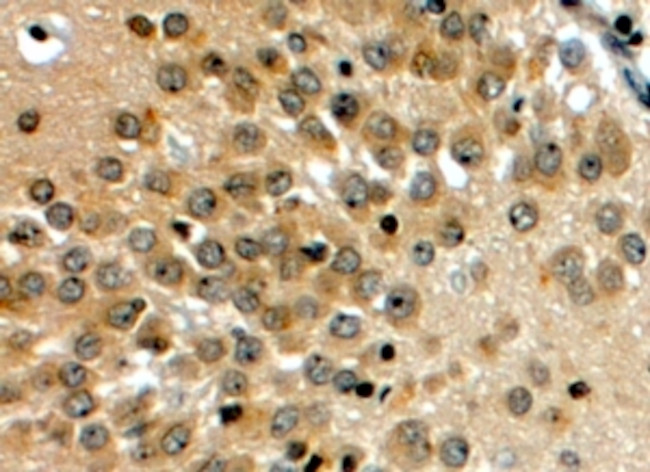 NOTCH3 Antibody in Immunohistochemistry (Paraffin) (IHC (P))