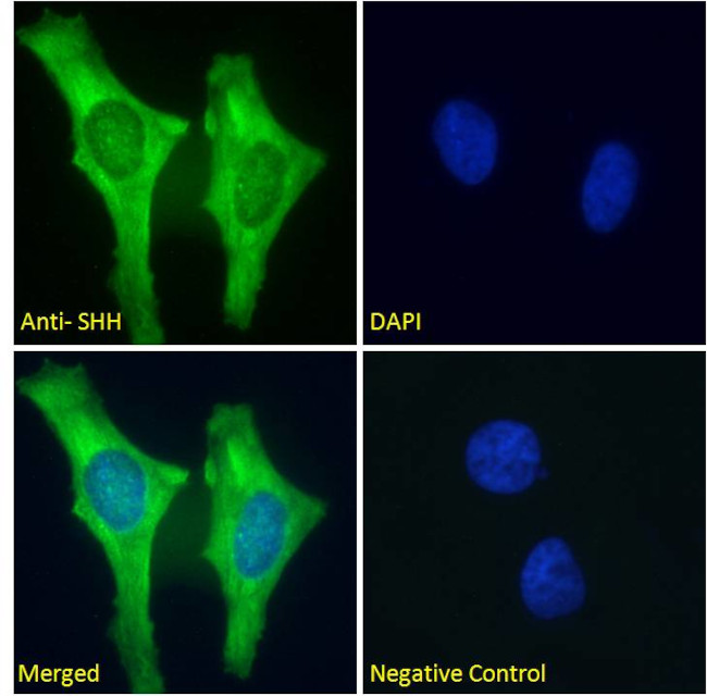 SHH Antibody in Immunocytochemistry (ICC/IF)