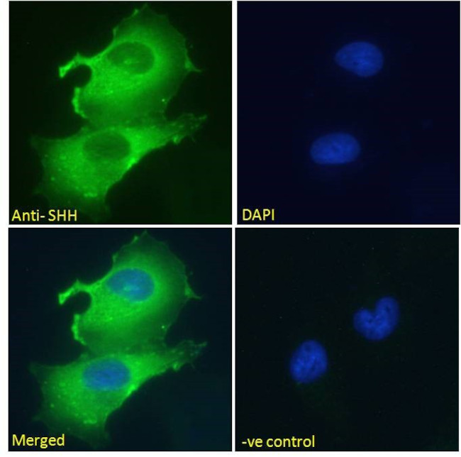 SHH Antibody in Immunocytochemistry (ICC/IF)