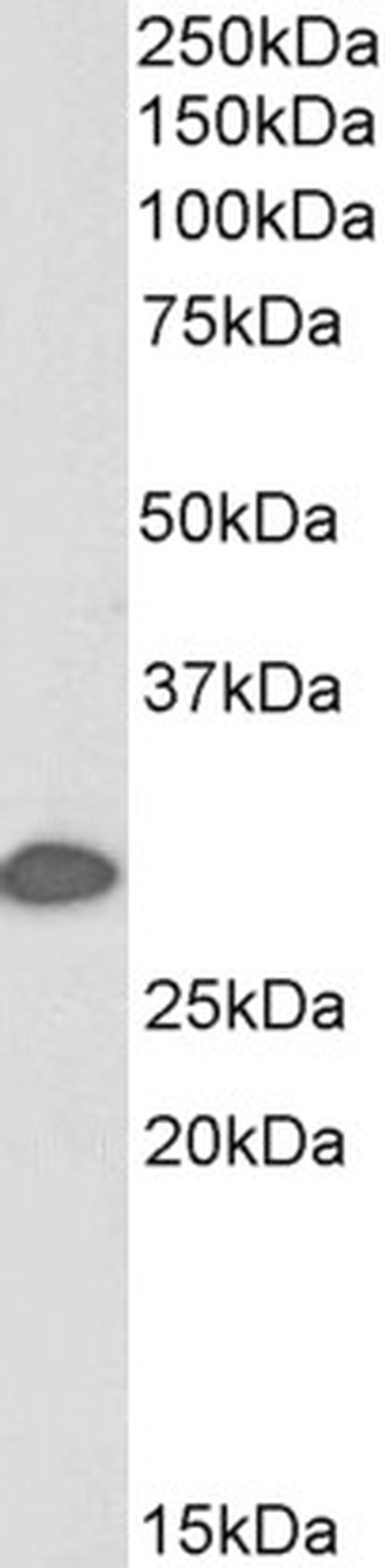 14-3-3 sigma Antibody in Western Blot (WB)