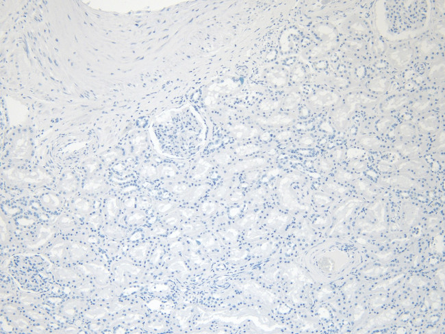 PRODH Antibody in Immunohistochemistry (Paraffin) (IHC (P))