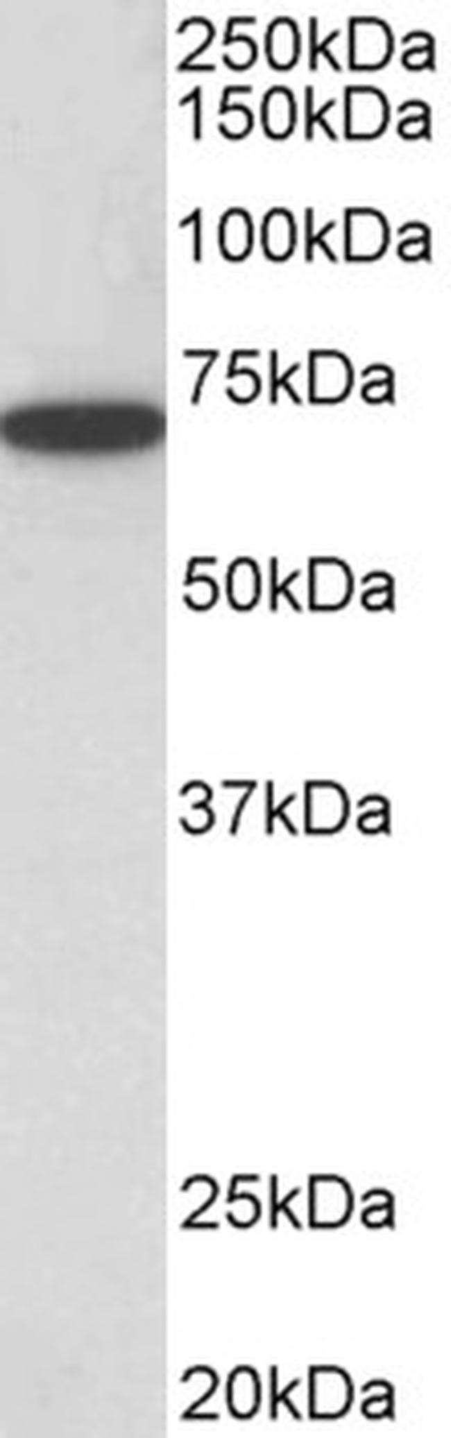 HDAC1 Antibody in Western Blot (WB)