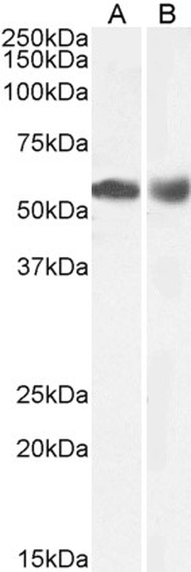 HDAC1 Antibody in Western Blot (WB)