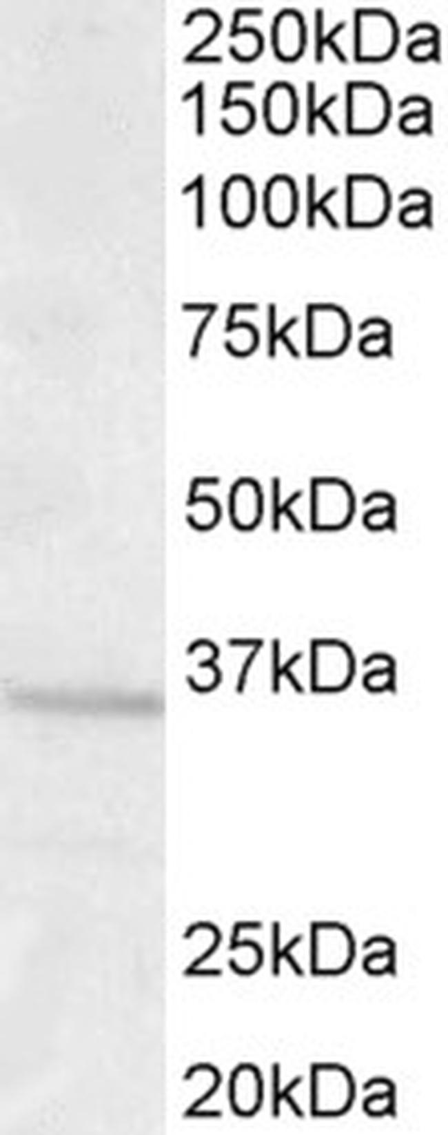 GNB3 Antibody in Western Blot (WB)