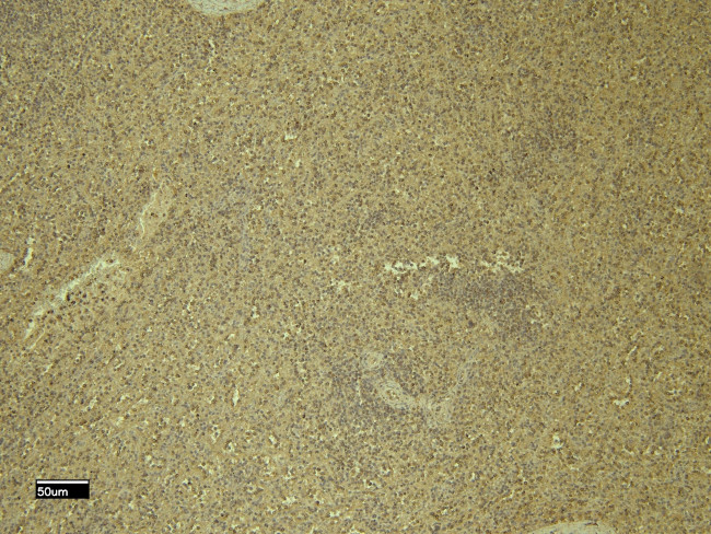 CXCR3 Antibody in Immunohistochemistry (Paraffin) (IHC (P))